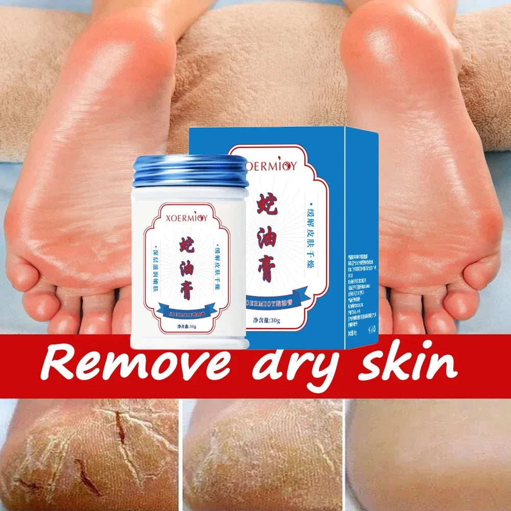 Beauty Product Herbal Anti Crack Foot Cream Heel Cracking Repair Products Exfoliation Dead Skin Removal Softening Moisturize